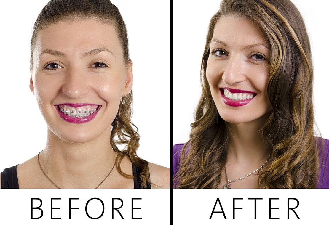 Orthodontic Transformations