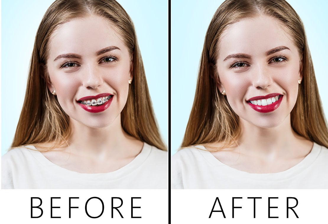 Orthodontic Transformation