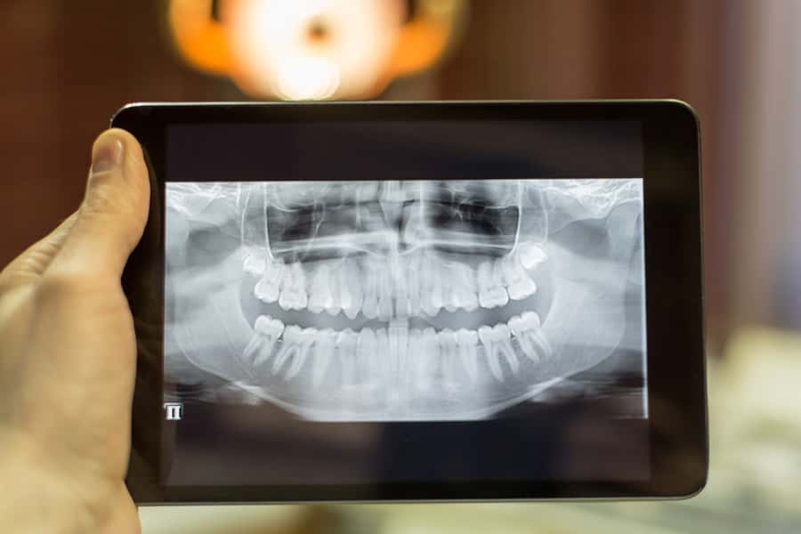 Digital Radiography in Milwaukee, WI, Beloit, WI and Roscoe, IL