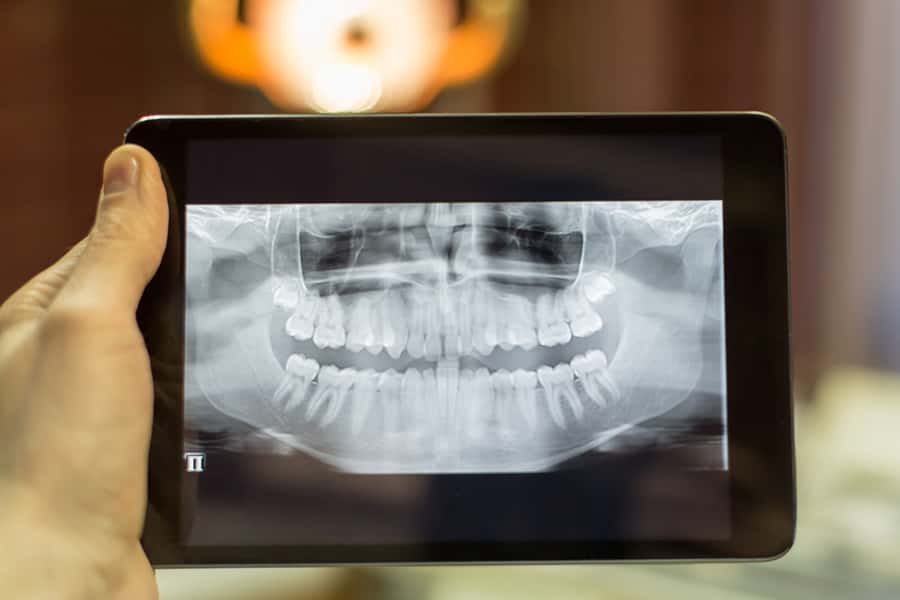 Our latest dental technology helps Dr. Ana Najjar, well-qualified cosmetic dentist in 53214, 53511, and 61073, determine which orthodontic treatment is right for you to straighten your smile! Digital Radiography in Milwaukee, WI, Beloit, WI and Roscoe, IL
