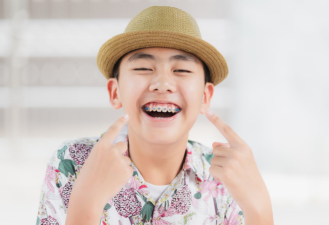 Untraditional Braces in Milwaukee, WI
