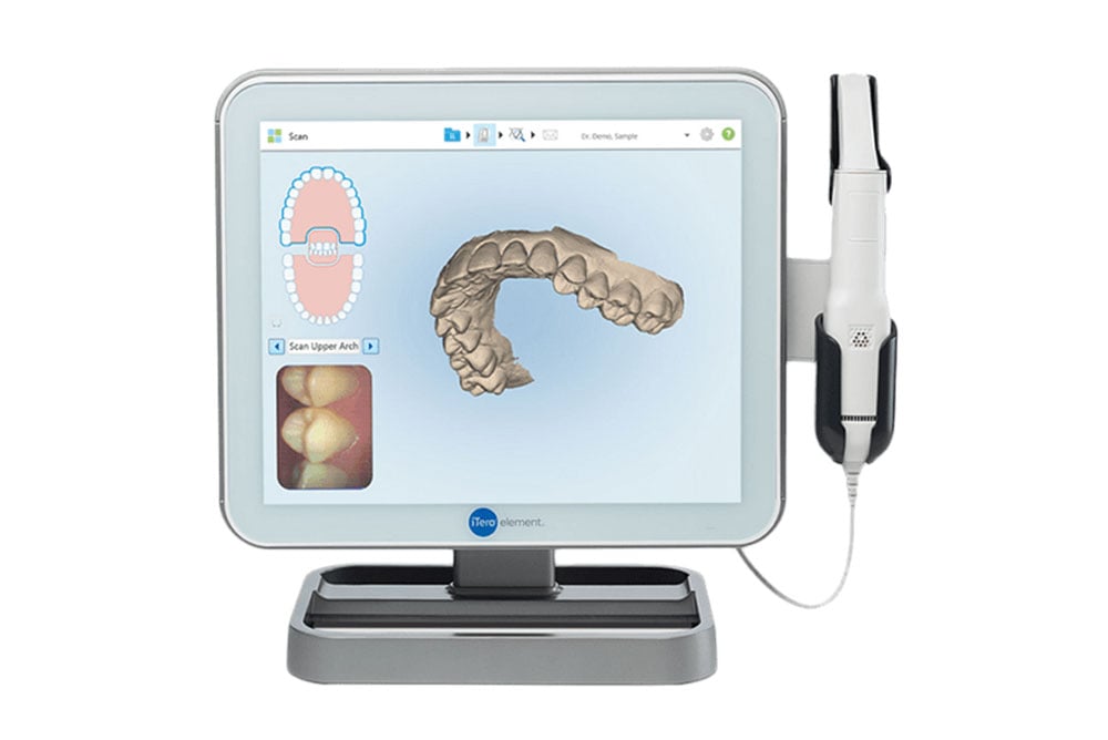 iTero Element digital impression scanner